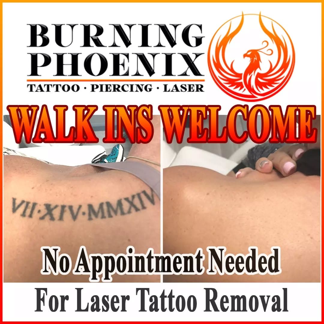 There is no appointment required for our LASER TATTOO REMOVAL services. Feel free to walk in during our business hours for any of our laser procedures. Burning Phoenix Studio, Yonkers,NY. @burningphoenixstudio
.
#westchester #westchestermoms #westchestermagazine #lasertreatment #skintreatment #lasertattooremoval #tattooremoval #skincare #tattoo #tattooing