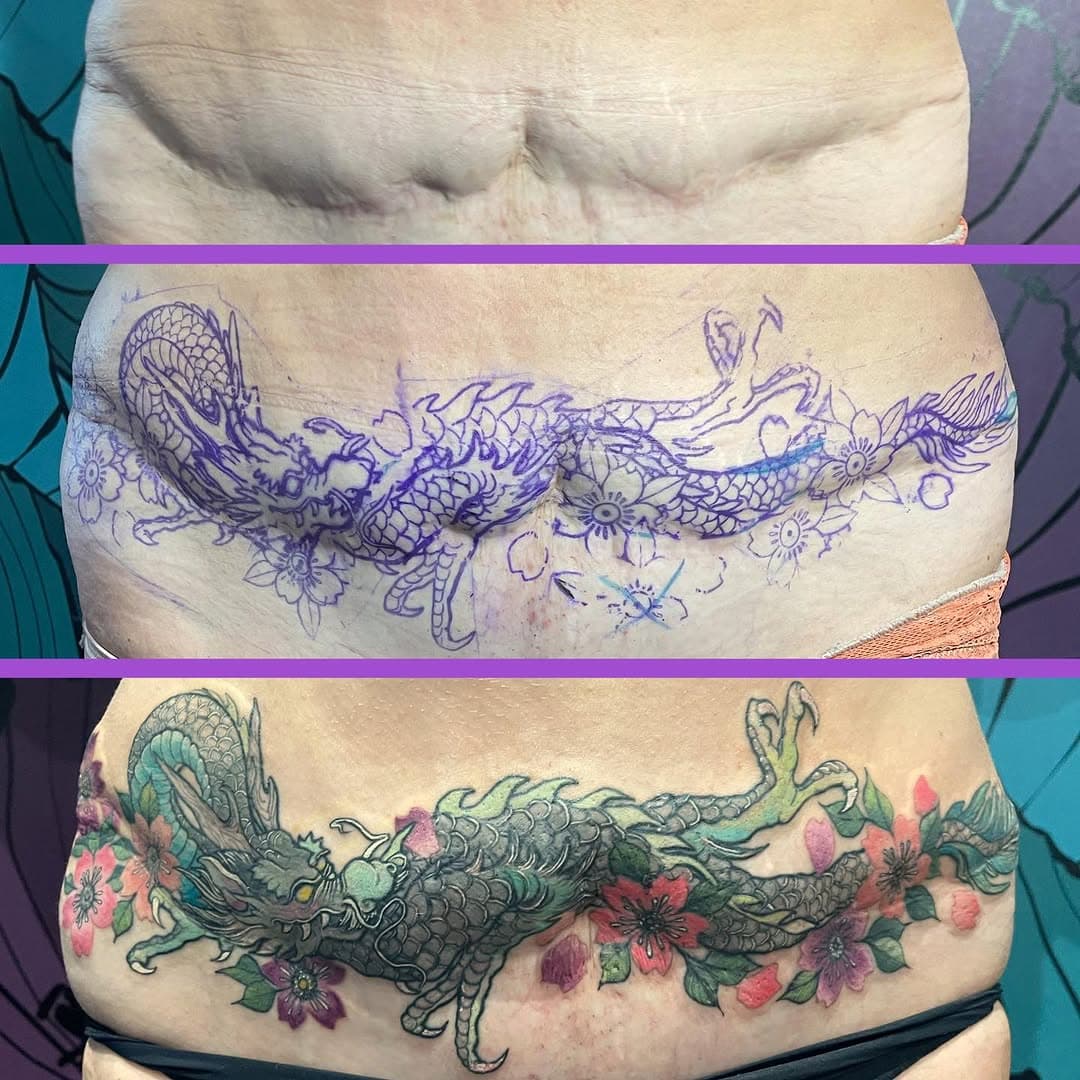 Recouvrement de cicatrices 💖 
Lines healed from last year, colours fresh. Merci mille fois à ma cliente pour ta confiance and courage! Premier tatouage pour elle 💖 très contente avec le résultat 🤩