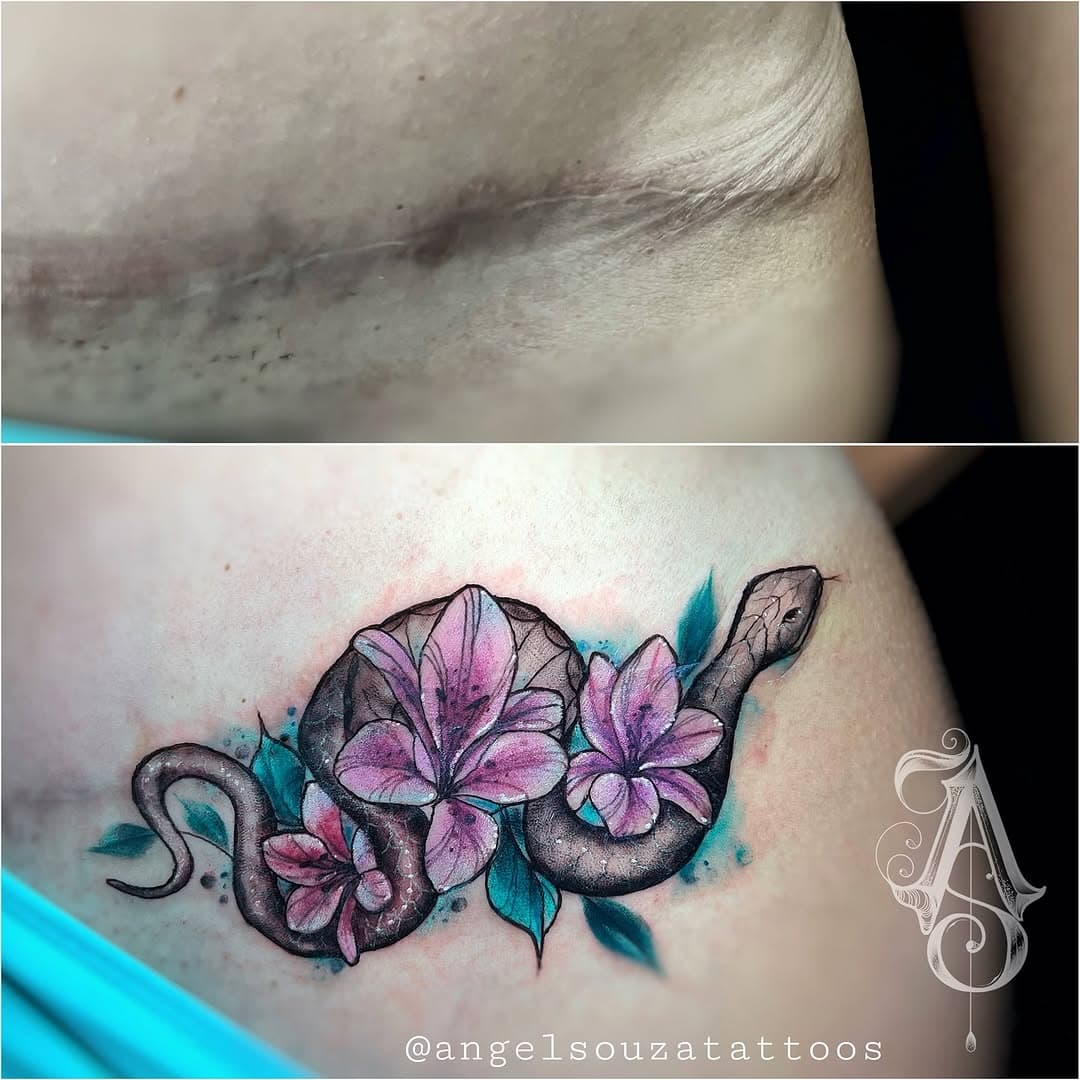 Cobertura de cicatriz #abdominoplastia 🙏____________________________________
#angelsouzatattoos 
#rosasnegrastatuagem
#euusoironworks 
#tattoo
#tatuagemcolorida
#tattooart
#tatuagem
#tatuadoras
#tattoogirl
#tattoocolor
#attoocolorida
#fullcolortattoo
#fullcolortattoos
#colortattoo
#tatuagemabdominoplastia 
#tattooabdominoplastia 
#coberturaabdominoplastia