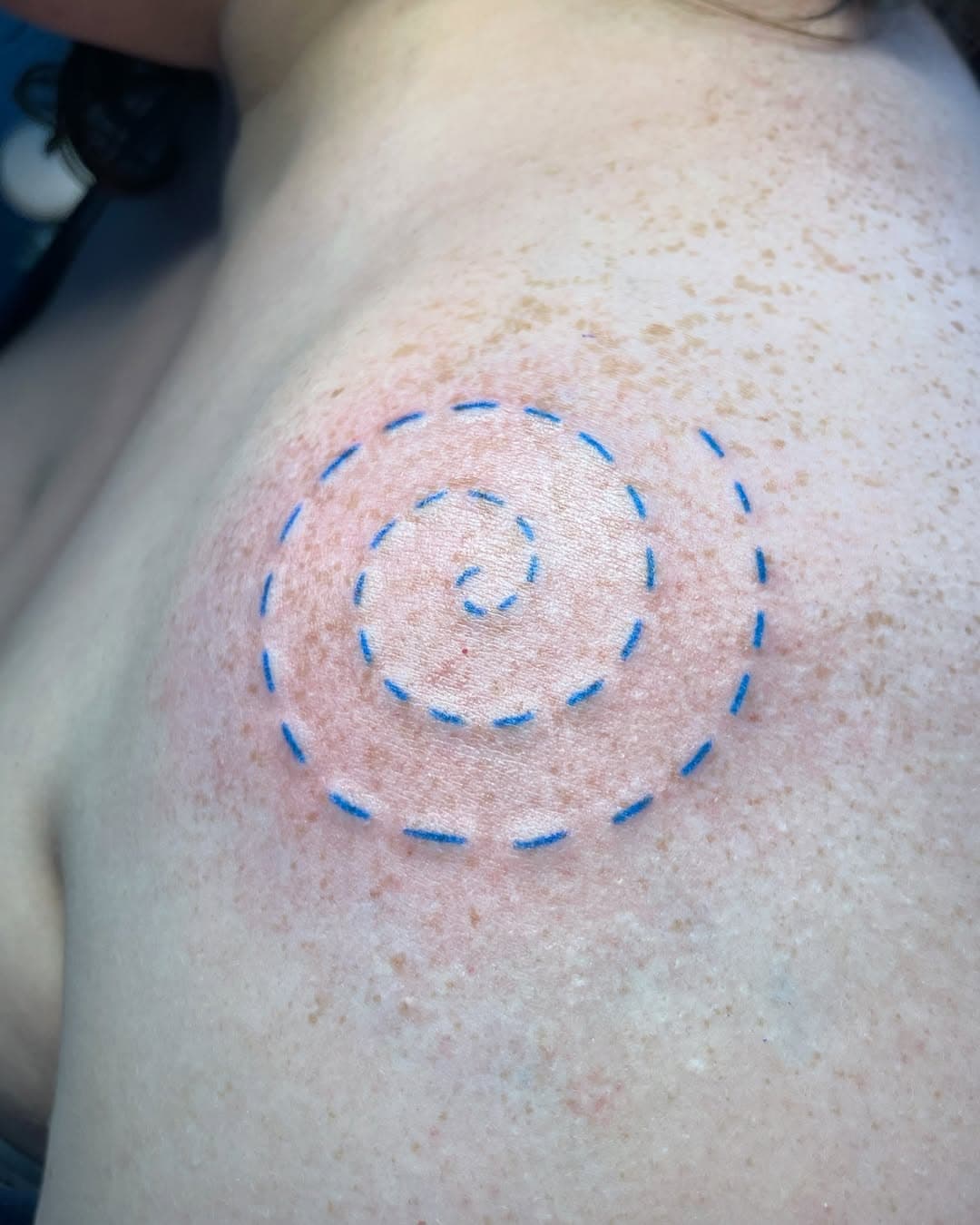 Honored to create this meaningful piece: a spiral of 36 stitches representing 36 years of life (and counting!). A huge thank you to my client for traveling from Louisiana for her first tattoo, it was so nice meeting her and the guests she brought along.

(Also, she chose this beautiful shade of blue which looks wonderful on her!)

✨ Currently booking for November & December 

✨ Keep an eye out for new flash pieces soon! I’ll be keeping my schedule updated and am open to custom requests. My booking link is in my bio, but always feel free to shoot me a message.