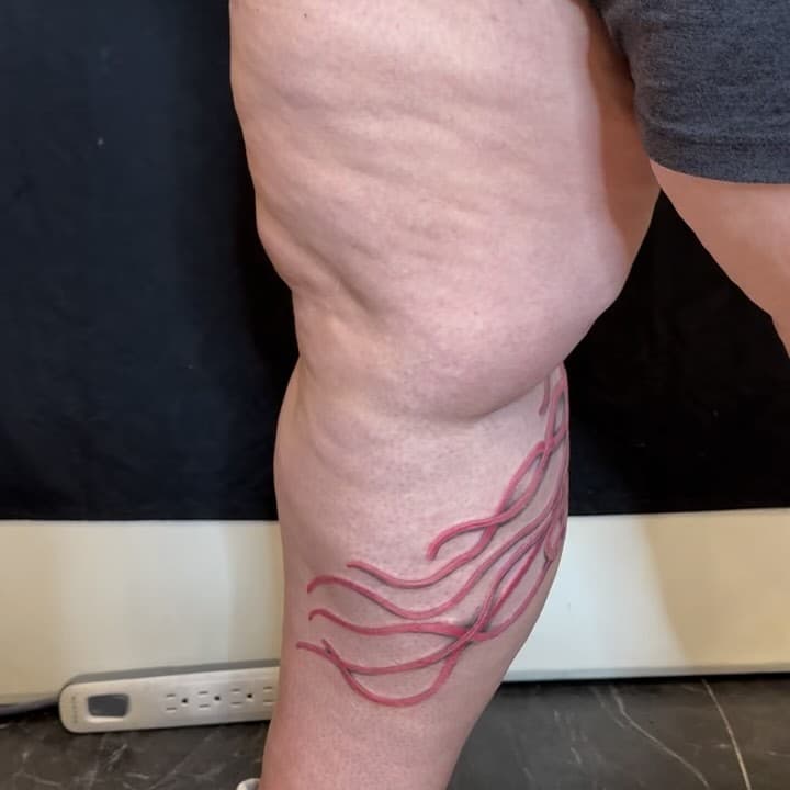 This was a hard image to get a picture of so here’s a video, a stitch, and all the individual pieces.  Single needle black line around the entire thing to hold it together.  Most of the tattoo is healed.  We discussed plans to create some other under water ocean life to help push it forward in 2025.  Thanks for looking.
.
.
.
#jellyfishtattoo #colortattoo #drawon #blackwatertattooanddesign #loudoncounty