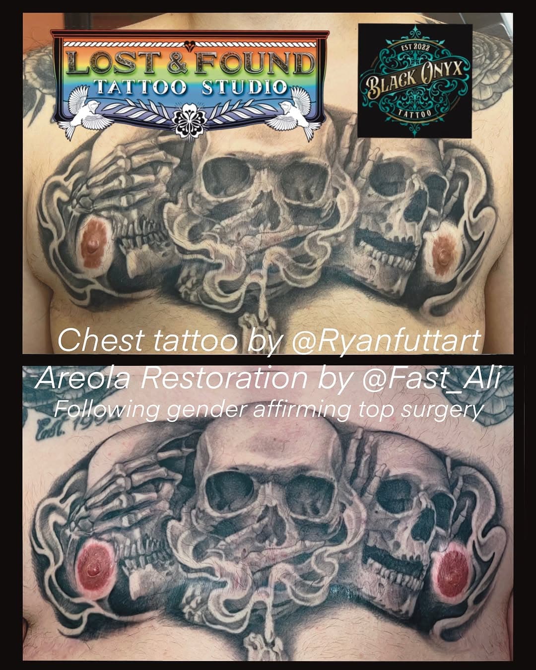 Healed Chest #tattoo by @ryanfuttart, owner/operator @blackonyx.tattoo 
Areola restoration (1st session fresh) tattooing by @fast_ali owner/operator @lostandfoundtattoostudio 

Thank you Ryan for the recommendation!
#tattoocollab